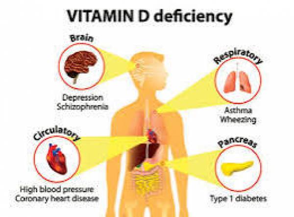 Ini yang Terjadi pada Tubuh Jika Kekurangan Vitamin D